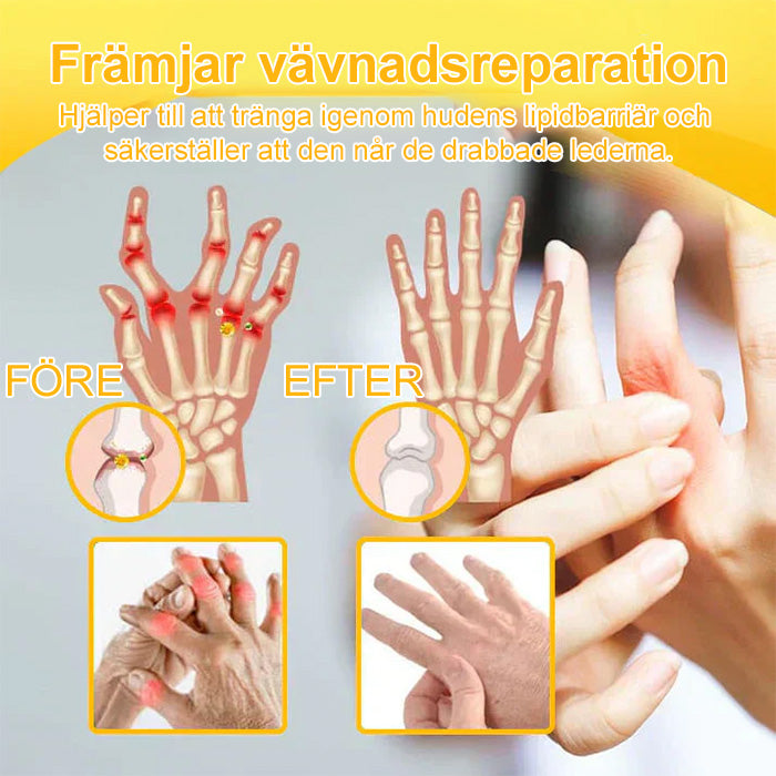 ✅Officiell butik: flysmus™ Bee-Venom Pain-Relief Bone Healing Cream👨⚕️ Godkänd av Svenska Ortopediska Föreningen (SOF) (Minskar ledvärk, rodnad,svullnad, stelhet,värme, ömhet och ledtrötthet)