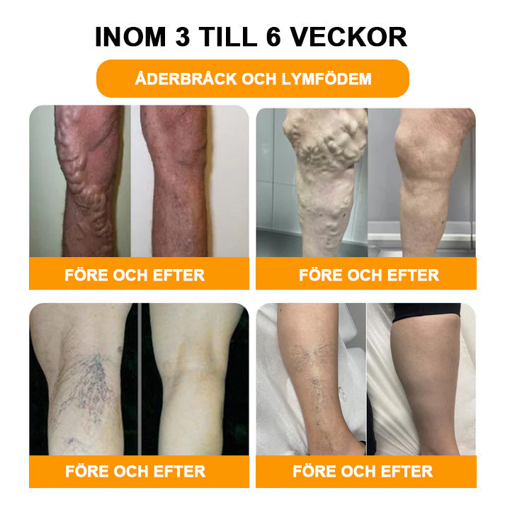 đ±đGFOUKâą (30 vĂ€xtbaserade ingredienser) Lymfatisk drĂ€nering Fotbad för viktminskning đŠ”đ© (Lymfatisk terapi rekommenderas av Svenska Lymfatiska SĂ€llskapet)