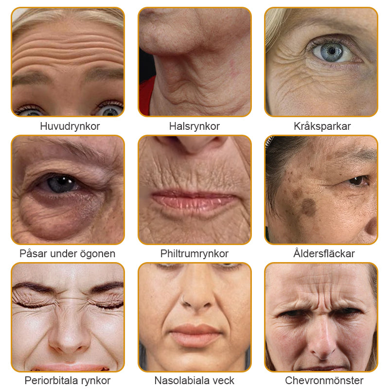 Sista Dagen-kampanj 70 % RABATT!-Furzero™ Botox Bee Venom Wrinkle Removal Cream-Tillverkad och skickad från Sverige!
