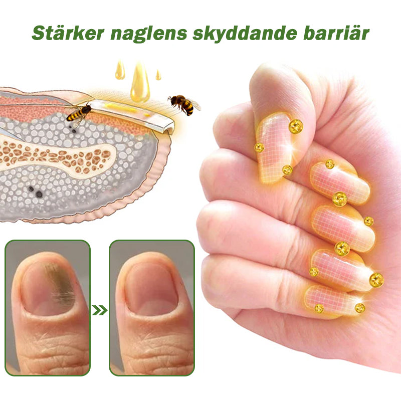 đšââïžFurzeroâą Nagelförsvar Bivensbehandlingsserum(För alla typer av nagelsjukdomarâ
För hÀlsosammare nageltillvÀxt)