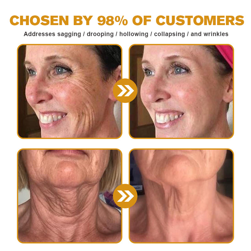 (🤓Made and Shipped from Canada✅) 👩⚕️Furzero™ Botox Bee Venom Wrinkle Removal Cream-(LAST DAY 70% OFF)
