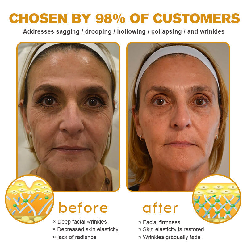 (🤓Made and Shipped from Canada✅) 👩⚕️Furzero™ Botox Bee Venom Wrinkle Removal Cream-(LAST DAY 70% OFF)