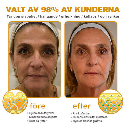 (🪂Tillverkad och skickad från Sverige✅) 👩‍⚕️Furzero™ Botox Bivax Anti-Aging Kräm - (SISTA DAGEN 70% RABATT)