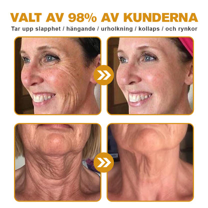 (🪂Tillverkad och skickad från Sverige✅) 👩‍⚕️Furzero™ Botox Bivax Anti-Aging Kräm - (SISTA DAGEN 70% RABATT)