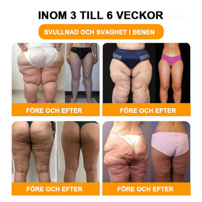 🌱🍋‍🟩GFOUK™ (30 växtbaserade ingredienser) Lymfatisk dränering Fotbad för viktminskning 🦵👩 (Lymfatisk terapi rekommenderas av Svenska Lymfatiska Sällskapet)