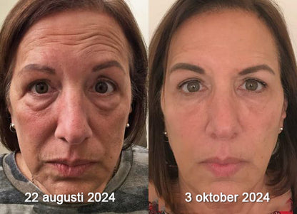 (🪂Tillverkad och skickad från Sverige✅) 👩‍⚕️Furzero™ Botox Bivax Anti-Aging Kräm - (SISTA DAGEN 70% RABATT)