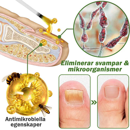 👨‍⚕️Furzero™ Nagelförsvar Bivensbehandlingsserum(För alla typer av nagelsjukdomar✅För hälsosammare nageltillväxt)
