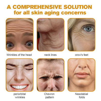 (🤓Made and Shipped from Canada✅) 👩‍⚕️Furzero™ Botox Bee Venom Wrinkle Removal Cream-(LAST DAY 70% OFF)