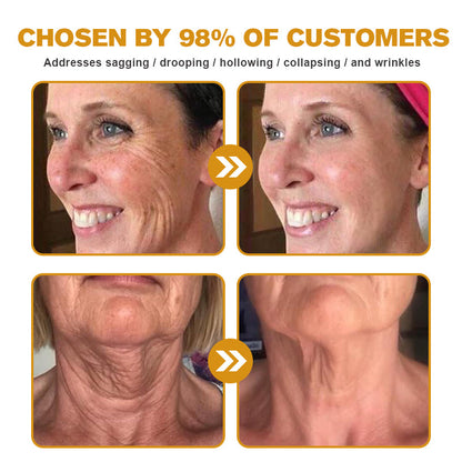 (🤓Made and Shipped from Canada✅) 👩‍⚕️Furzero™ Botox Bee Venom Wrinkle Removal Cream-(LAST DAY 70% OFF)