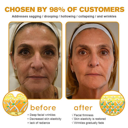 (🦜Made and Shipped from Canada✅) 👩‍⚕️Furzero™ Botox Bee Venom Wrinkle Removal Cream-(LAST DAY 70% OFF)